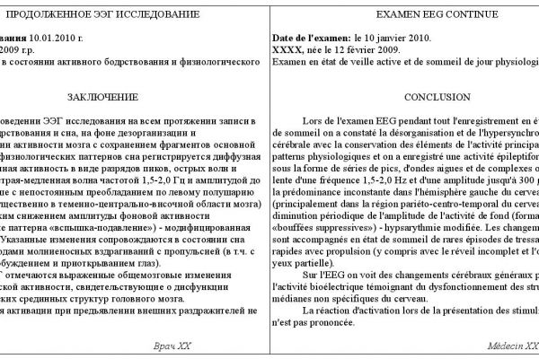 Заключение ЭЭГ (рус-франц)