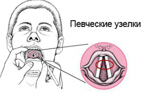 Узлы на связках