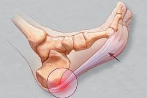 Апоневроз это