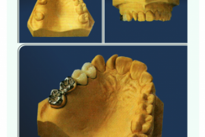 Ретушь до и после 2