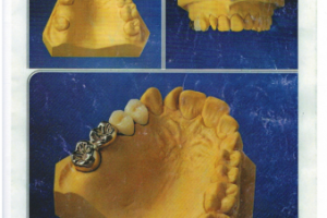 Ретушь до и после