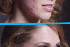 Ретушь кожи на фото