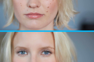 Ретушь кожи на фото