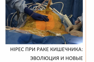 HIPEC ПРИ РАКЕ КИШЕЧНИКА: ЭВОЛЮЦИЯ И НОВЫЕ ГОРИЗОНТЫ