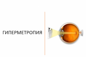 ГИПЕРМЕТРОПИЯ