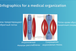 Infographics for a medical organization