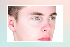 Удаление дефектов кожи