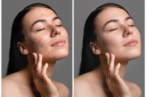 Восстановление