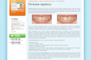 Лечение кариеса