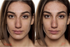 Удаление " дефектов"