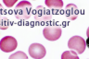 Рекламное объявление в фейсбуке