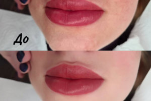 Ретушь лица