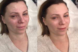 Ретушь лица