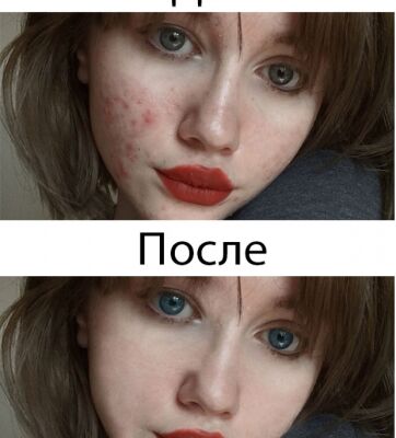 img3630253.png