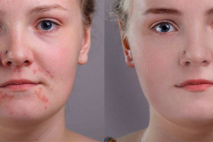 Ретушь кожи, частотное разложение