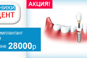 БАННЕР | Акция