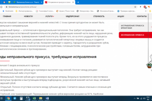 Исправление прикуса