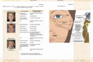 иллюстрации в журнал "Морфотипы старения"