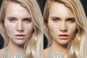 Удаление дефектов с кожи и цветокоррекция