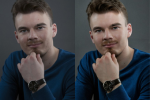 Чистка кожи