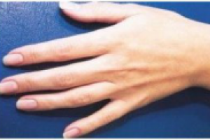 Natural Nail Care System