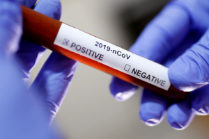 Рекомендации чтобы не заболеть короновирусом