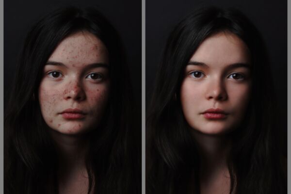 img4230124.png