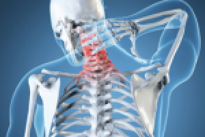 Шейная головная боль