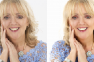 Возрастная ретушь