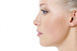 Риносептопластика