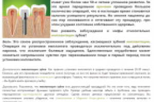 Заблуждения, касающиеся имплантации