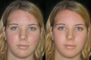 Ретушь фото