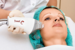 Противопоказания к фраксель