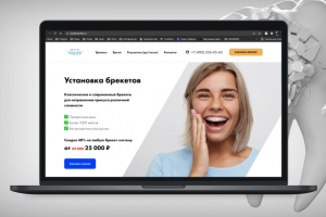 bracessmile.ru / Сайт для стоматологии "Beauty Smile" в Москве