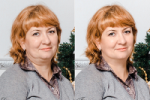 Убрать подбородок 1