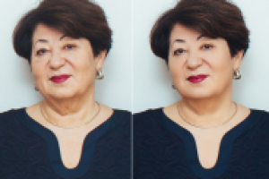 убрать подбородок 4