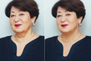 убрать подбородок 5