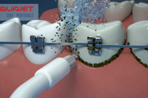 Irrigator animation 3D