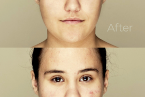 Ретушь лица