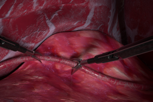 Nexus. Робот хирург