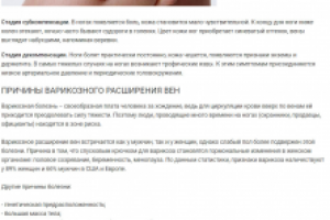 Варикозное расширение вен