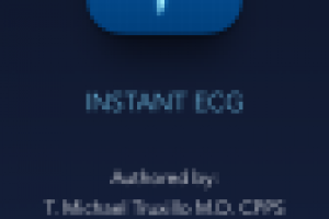 Instant ECG