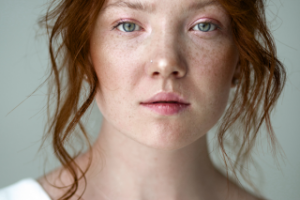 high end веснушки