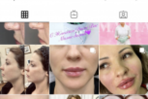 Ниша БЬЮТИ Косметология. Эпиляция. Москва