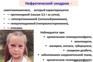 Нефротический синдром у детей