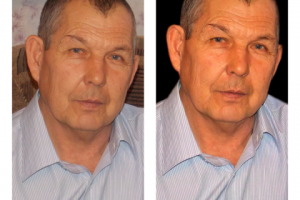 обработка(ретушь) до и после