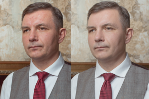 Ретушь кожи