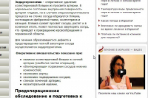 Эндартерэктомия