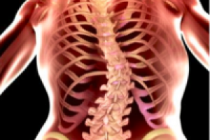 Можно ли заниматься спортом при сколиозе