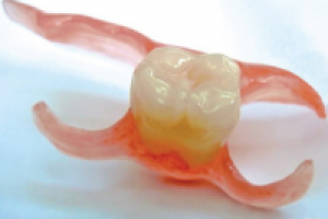 Нейлоновые или акриловые протезы (все за и против в одной статье